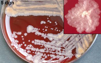 Gordonia bronchialis  culture incubated with O2