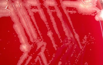 Gordonia bronchialis  culture incubated with O2