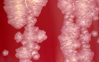 Gordonia bronchialis  culture incubated with O2