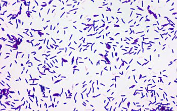 Gordonia bronchialis Gram stain