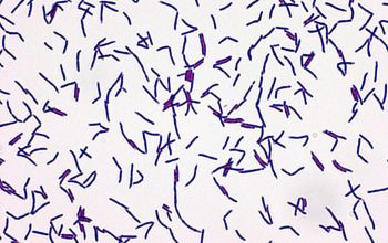 Gordonia polyisoprenivorans Gram stain