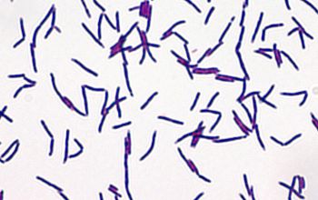 Gordonia polyisoprenivorans Gram stain