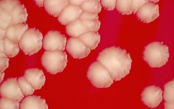 Gordonia sputi Blood Agar 48h culture incubated with O2