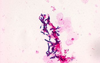 Gordonia sputi Gram stain