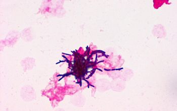 Gordonia sputi Gram stain