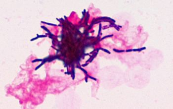 Gordonia sputi Gram stain