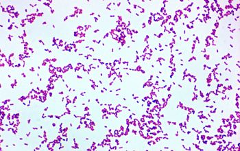 Granulicatella adiacens Gram stain