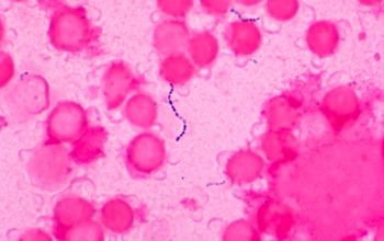 Granulicatella adiacens Gram stain