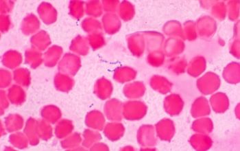 Granulicatella adiacens Gram stain