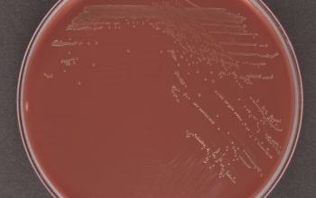 Haemophilus haemolyticus Chocolate Agar 24h culture incubated with CO2