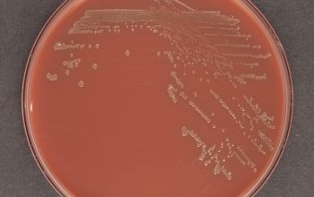 Haemophilus haemolyticus Chocolate Agar 48h culture incubated with CO2