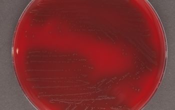 Haemophilus haemolyticus  culture incubated with CO2