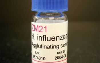 Haemophilus influenzae  culture 