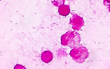 Haemophilus influenzae Gram stain