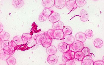 Haemophilus influenzae Gram stain