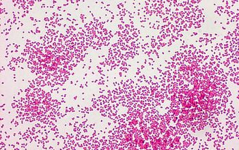 Haemophilus influenzae Gram stain