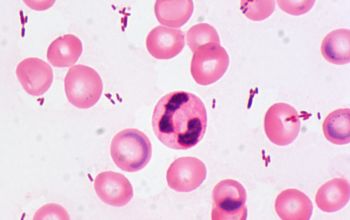 Haemophilus influenzae Gram stain