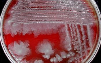 Hafnia alvei Blood Agar 48h culture 