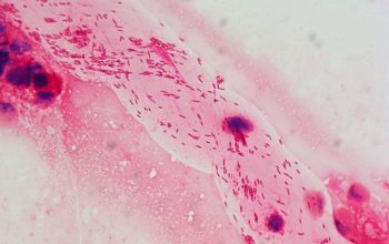 Helicobacter pylori Gram stain