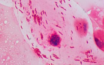 Helicobacter pylori Gram stain