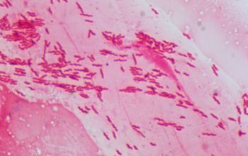 Helicobacter pylori Gram stain