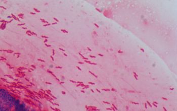 Helicobacter pylori Gram stain