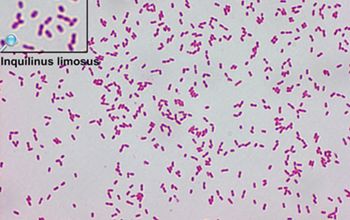 Inquilinus limosus Gram stain