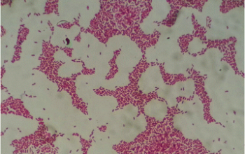 Kerstersia gyiorum Gram stain