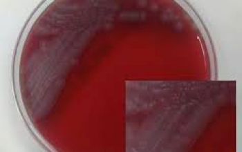 Kerstersia gyiorum Blood Agar 48h culture incubated with CO2
