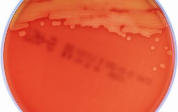 Kingella kingae Blood Agar 48h culture incubated with CO2