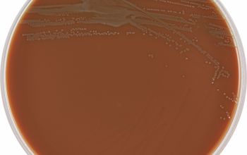 Kingella kingae Chocolate Agar 48h culture incubated with CO2