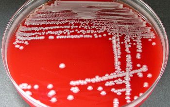 Klebsiella oxytoca Blood Agar 24h culture incubated with CO2