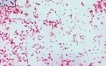 Klebsiella ozaenae (K. pneumoniae subsp. ozaenae) Gram stain