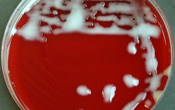 Klebsiella ozaenae (K. pneumoniae subsp. ozaenae) Blood Agar 24h culture incubated with CO2