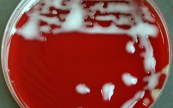 Klebsiella ozaenae Blood Agar 24h culture incubated with CO2