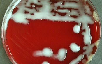 Klebsiella ozaenae (K. pneumoniae subsp. ozaenae) Blood Agar 48h culture incubated with O2