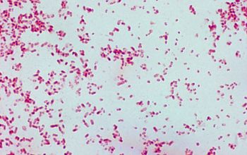 Klebsiella ozaenae (K. pneumoniae subsp. ozaenae) Gram stain