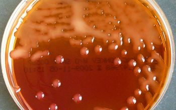 Klebsiella ozaenae (K. pneumoniae subsp. ozaenae) Mac Conkey Agar without salt 24h culture incubated with CO2