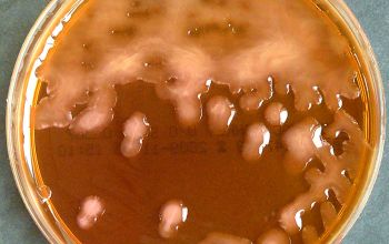 Klebsiella ozaenae (K. pneumoniae subsp. ozaenae) Mac Conkey Agar without salt 48h culture incubated with O2