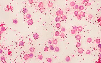 Klebsiella pneumoniae Gram stain