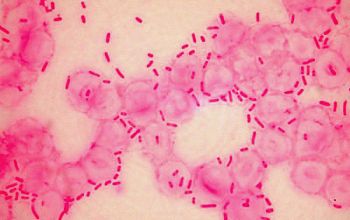 Klebsiella pneumoniae Gram stain