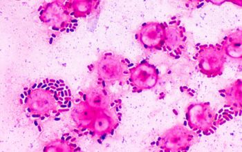 Klebsiella pneumoniae Gram stain