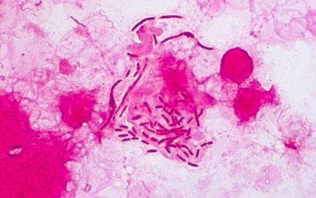 Klebsiella pneumoniae Gram stain