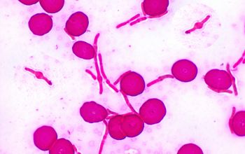 Klebsiella pneumoniae Gram stain