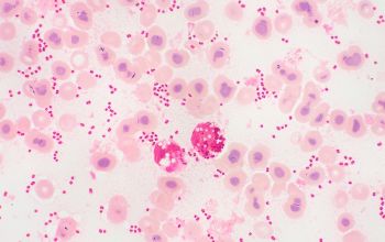 Klebsiella variicola Gram stain