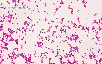 Kluyvera species Gram stain