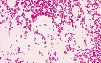 Kluyvera species Gram stain