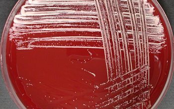 Kocuria kristinae (Rothia kristinae) Blood Agar 24h culture incubated with CO2