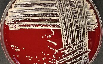 Kocuria kristinae (Rothia kristinae) Blood Agar 48h culture incubated with O2