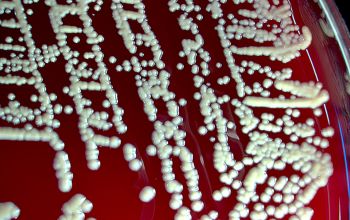 Kocuria kristinae (Rothia kristinae) Blood Agar 48h culture incubated with O2